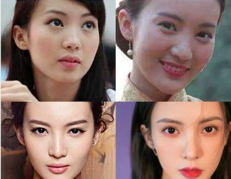 美女整容前后对比_混血女明星鼻子_娱乐圈整容美女